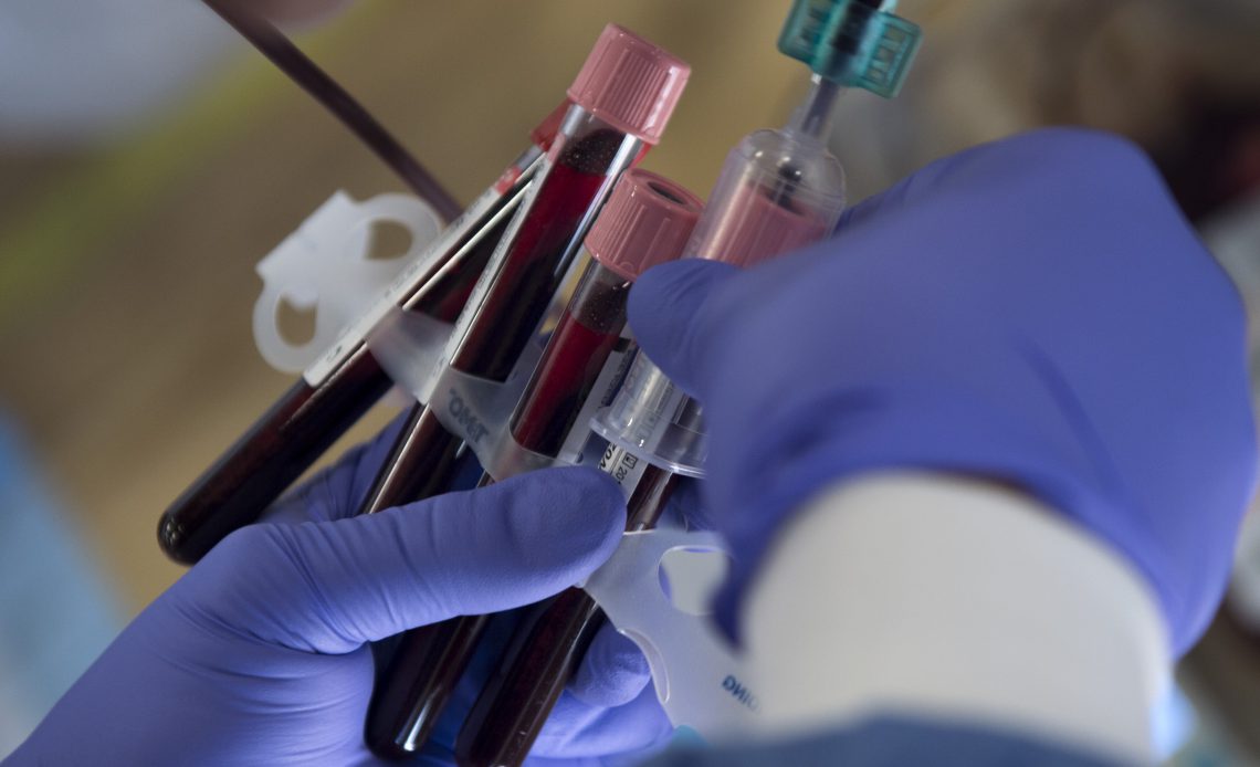Blood pumps into test tubes during the Armed Services Blood Bank Center’s blood donation on Joint Base Andrews, Md., Feb. 6, 2017. The test tubes are used to test for blood-borne pathogens in order to make sure the approximately 450 to 500 milliliters of blood donated is safe to be used when needed. (U.S. Air Force photo by Senior Airman Philip Bryant)